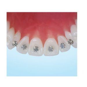 Centric Orthodontics TONGUE TRAINERS